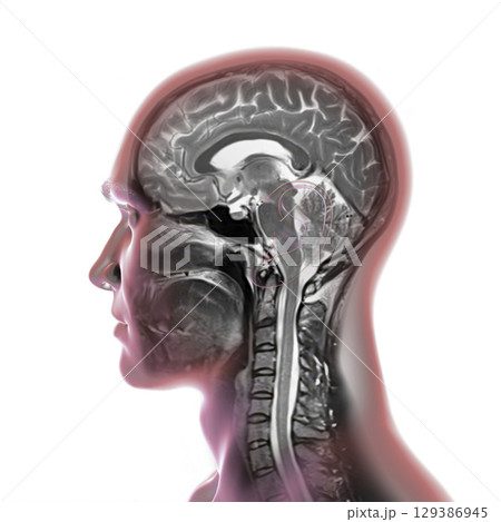 Brain anatomy MRI, illustration 129386945