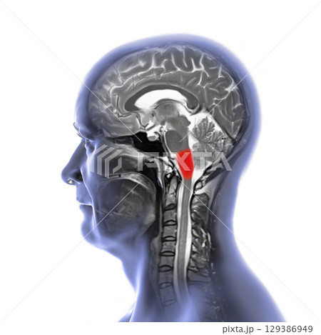 Medulla oblongata MRI, illustration Medulla oblongata MRI, illustration 129386949