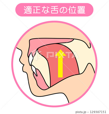 正しいミューイングの方法 適正な舌の位置と誤った舌の位置 正しいミューイングの方法 適正な舌の位置と誤った舌の位置 129387151
