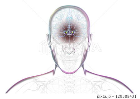 Human brain with degenerated substantia nigra in Parkinson's disease, 3D illustration. 129388431