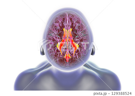 Ventricular system of the brain, 3D illustration Ventricular system of the brain, 3D illustration 129388524