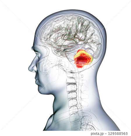 Human brain with highlighted cerebellum, 3D illustration Human brain with highlighted cerebellum, 3D illustration 129388563
