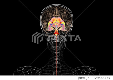 Normal pressure hydrocephalus, 3D illustration 129388775