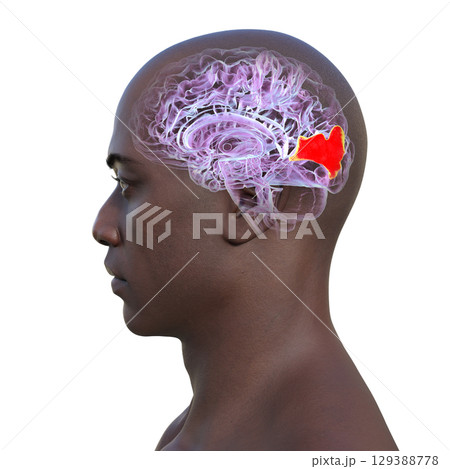 Human brain with highlighted cuneus gyrus, 3D illustration Human brain with highlighted cuneus gyrus, 3D illustration 129388778