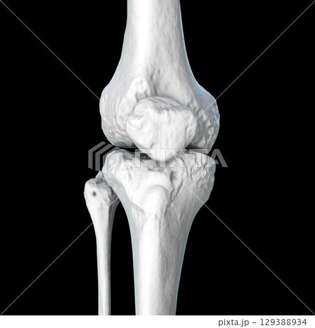 Knee joint bones anatomy, 3D illustration Knee joint bones anatomy, 3D illustration 129388934