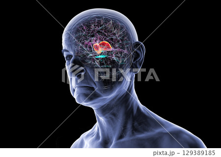 Thalamus in human brain, 3D illustration 129389185