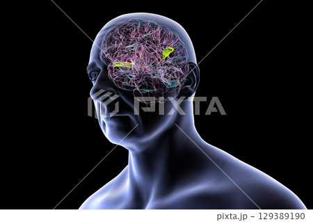 Human brain with the transverse temporal gyri, 3D illustration 129389190