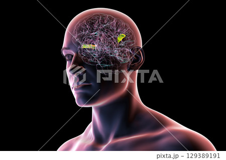 Human brain with the transverse temporal gyri, 3D illustration 129389191