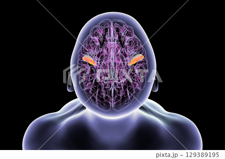 Human brain with the transverse temporal gyri, 3D illustration 129389195