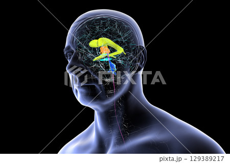 Human brain with colored ventricles, 3D illustration, lateral (yellow), third (orange), fourth (blue), interventricular foramen (green), cerebral aqueduct (dark purple), spinal channel (light purple). Human brain with colored ventricles, 3D illustration, lateral (yellow), third (orange), fourth (blue), interventricular foramen (green), cerebral aqueduct (dark purple), spinal channel (light purple). 129389217
