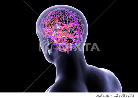 Human brain with highlighted blood vessels, 3D illustration. 129389272