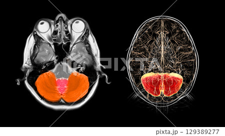 Cerebellum MRI scan, illustration 129389277