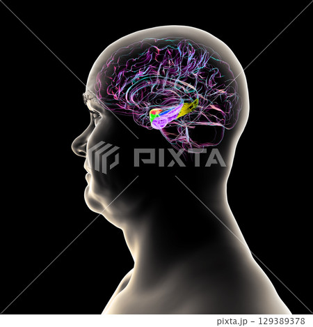 Human brain mid-section with highlighted amygdala (red), hippocampus (blue), parahippocampal gyrus and associated cortices: perirhinal (green), entorhinal (purple), parahippocampal (yellow). Human brain mid-section with highlighted amygdala (red), hippocampus (blue), parahippocampal gyrus and associated cortices: perirhinal (green), entorhinal (purple), parahippocampal (yellow). 129389378