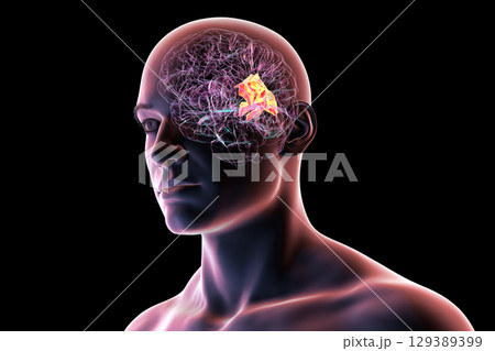Human brain with highlighted precuneus gyrus, 3D illustration Human brain with highlighted precuneus gyrus, 3D illustration 129389399