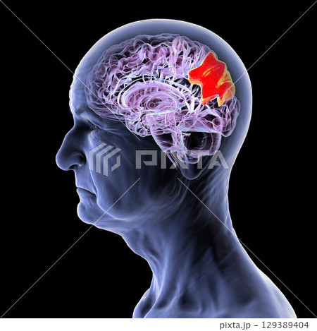 Human brain with highlighted precuneus gyrus, 3D illustration 129389404