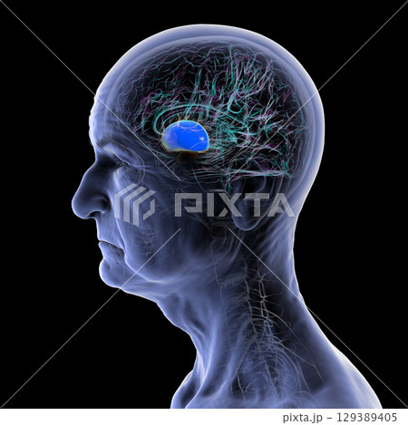 Putamen in elderly brain, 3D illustration Putamen in elderly brain, 3D illustration 129389405