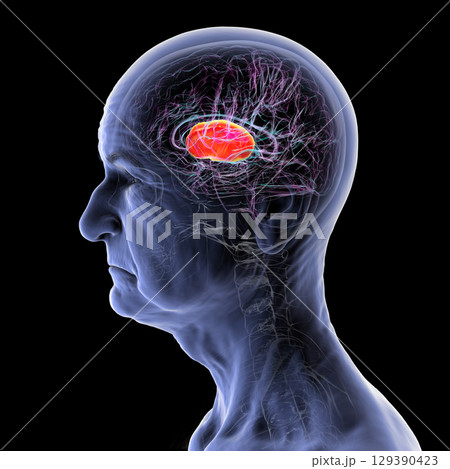 Internal capsule, 3D illustration. Highlighted in red within the human brain. Internal capsule, 3D illustration. Highlighted in red within the human brain. 129390423