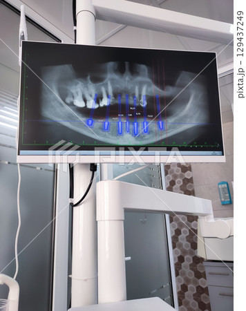 Detailed dental CT scan showing axial, coronal, sagittal, and 3D views of jaw and teeth for diagnostic and treatment plan 129437249