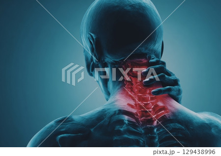 Neck pain diagnosis medical x-ray imaging healthcare facility clinical environment side view human anatomy insights 129438996