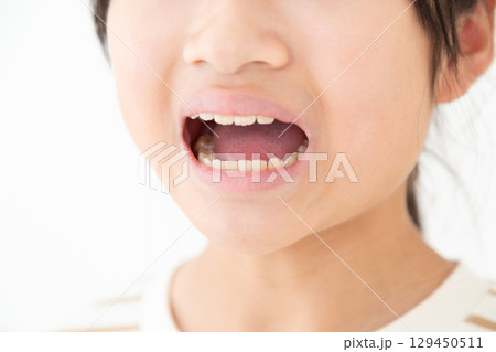 中学生の女の子の歯 129450511