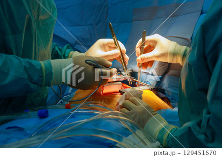 Multiple surgeons focus intently on complex surgery in operating room. Medical instruments and tools surround them, creating a serious atmosphere. 129451670