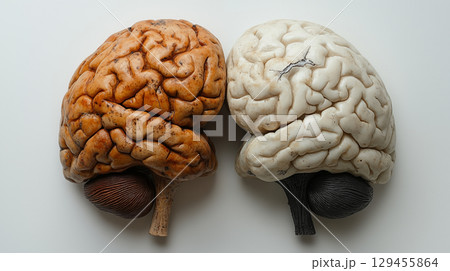 Human brain models displaying anatomical structure in orange and white, showcasing medical education and neuroscience research. Concept of neurology, psychology and mental health study 129455864