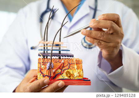 Asian dermatologist doctor holding skin structure model anatomy for treatment in hospital, hair transplant. 129485128
