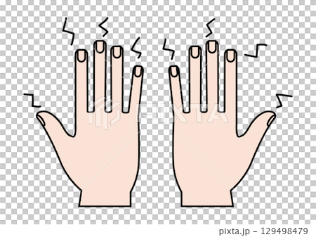 單純的手，指尖麻木疼痛 129498479