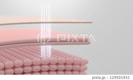 ハイフ(HIFU)がSMAS層に働きかけるリフトアップ治療のCG コピースペース ハイフ(HIFU)がSMAS層に働きかけるリフトアップ治療のCG コピースペース 129501932