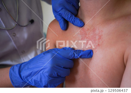 The doctor is examining the boy's skin. 129506437