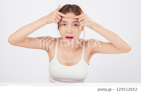 Acne on the forehead and acne near her cheek highlight a woman battle with skin blemishes, showing a raw and relatable skincare struggle with beauty in mind. isolated studio white background 129512652