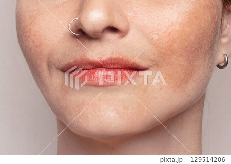 Cropped Womans face with pigmentation, melasma, freckles, age spots photo. Close up photo texture Cropped Womans face with pigmentation, melasma, freckles, age spots photo. Close up photo texture 129514206