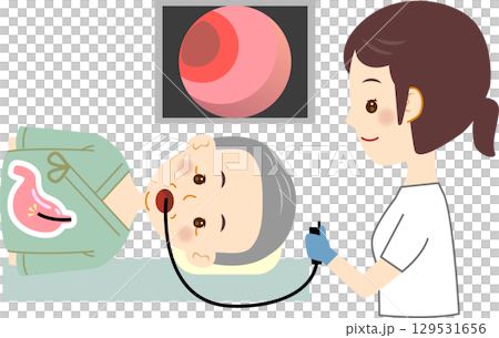 Senior man undergoing gastroscopy 129531656