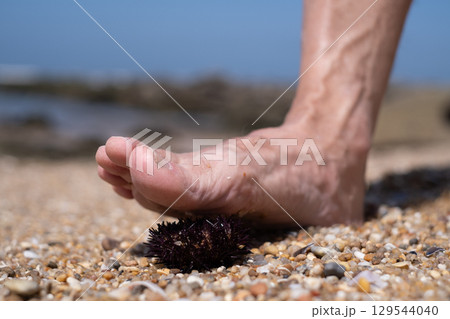 Foot Almost Stepped on a Sea Urchin 129544040