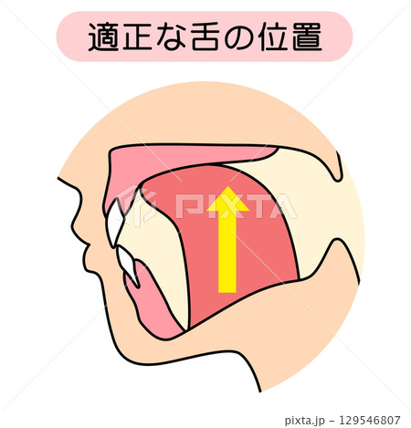 正しいミューイングの方法　適正な舌の位置と誤った舌の位置 129546807