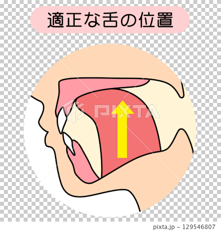 正しいミューイングの方法　適正な舌の位置と誤った舌の位置 129546807