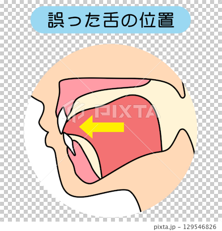How to mew properly: correct and incorrect tongue position 129546826