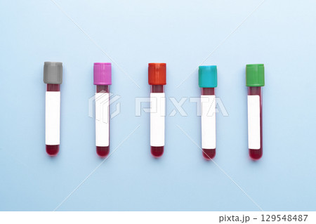 Blood sample test tubes set on blue background. Different blood collection tubes of various colors serve distinct purposes in clinical laboratory testing. Blood sample test tubes set on blue background. Different blood collection tubes of various colors serve distinct purposes in clinical laboratory testing. 129548487