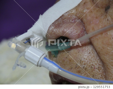 患者 病院 医療 129551753