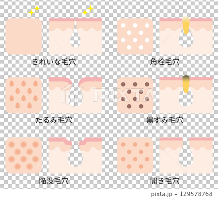 毛穴のトラブルイラスト 129578768