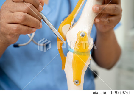 Osteoarthritis of the knee, Doctor holding human knee joint orthopedic anatomy model in hospital. Osteoarthritis of the knee, Doctor holding human knee joint orthopedic anatomy model in hospital. 129579761