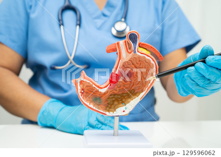 Stomach disease, doctor holding anatomy model for study diagnosis and treatment in hospital. 129596062