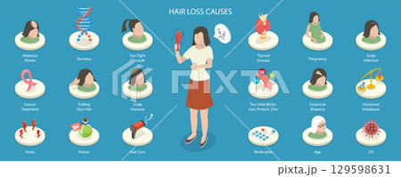 3D Isometric Flat Vector Illustration of Causes of baldness, Hair Loss 129598631