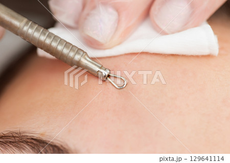 Deep cleaning of the female face with blackhead remover in the beauty salon, close up. Using steel tool for cleaning skin from blackheads and acne by cosmetologist 129641114