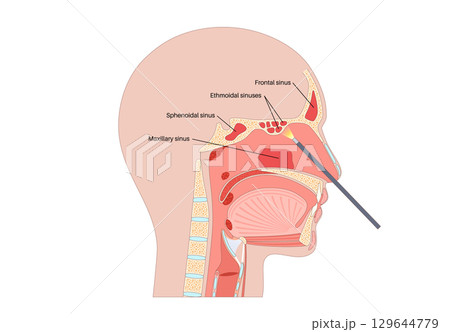 Sinuses in the human head Sinuses in the human head 129644779