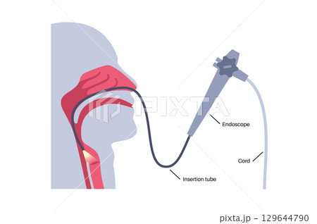 Laryngoscopy medical procedure 129644790