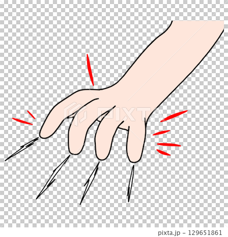 引っ掻く 引っ掻く 129651861