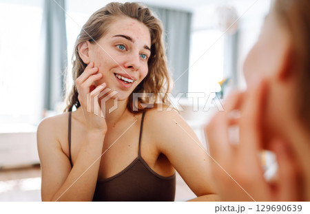 Skin problem. Natural beauty. Medical care and treatment concept. 129690639