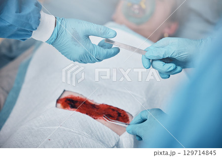 Hands, blood and operation with a team of doctors at work during surgery with equipment or a tool in a hospital. Doctor, nurse and collaboration with a medicine professional group saving a life 129714845