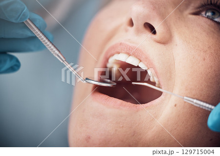 Teeth, dental or woman at a dentist for surgery, teeth whitening or mouth cleaning for gum disease bacteria. Wellness, tooth decay or hands helping or working with oral tools in healthcare clinic Teeth, dental or woman at a dentist for surgery, teeth whitening or mouth cleaning for gum disease bacteria. Wellness, tooth decay or hands helping or working with oral tools in healthcare clinic 129715004